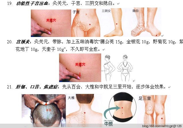 简单易学的艾灸 - 养生堂 - 养生堂