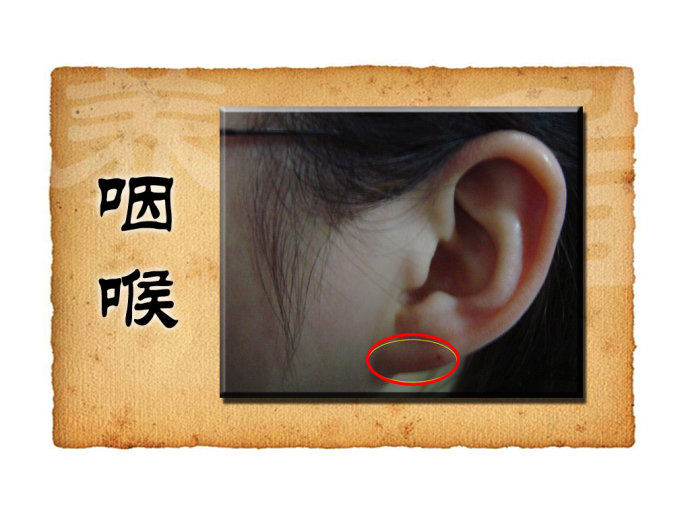 3月26日播出：耳朵泄露的秘密（1）鈥斺斖访嫖骞