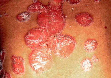 《根治各种皮肤顽疾偏方》 -   红杏妹 - 红杏妹