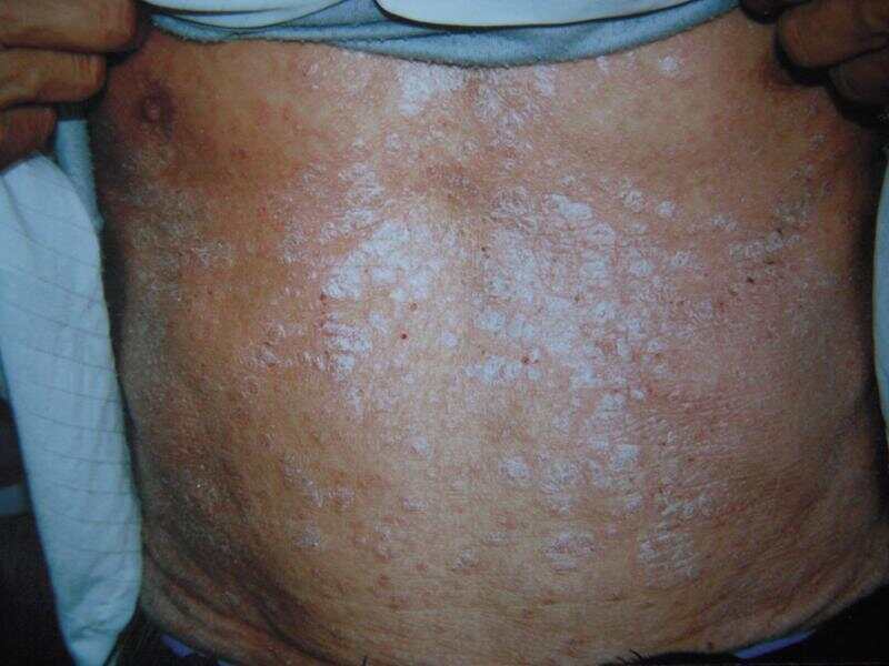 《根治各种皮肤顽疾偏方》 -   红杏妹 - 红杏妹