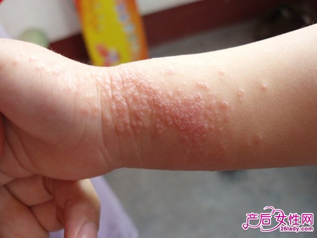 您和您身边的朋友有各种类型的皮肤病吗？别怕，【莲池佛地】专门给您贮备的：治疗各种皮肤疾病“怪”方法 - ufoetufo - 莲池佛地