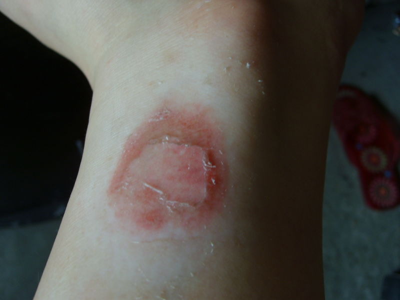 《根治各种皮肤顽疾偏方》 -   红杏 - 红杏