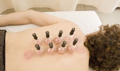 中医拔罐减肥的原理