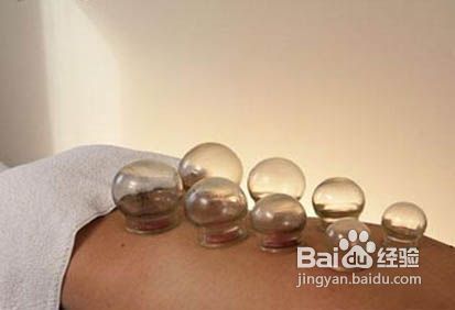 民间拔罐减肥中医的减肥法