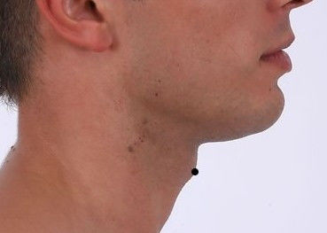 真人全身痣相图解 - 玖玖丸子 - .......