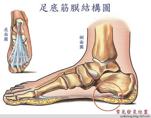 治疗“脚跟痛”的秘方 - 瀛子 - 瀛の小笺