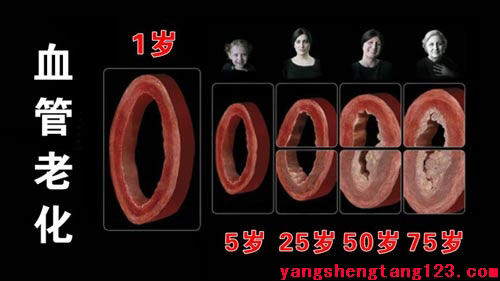 血管堵塞时你有感觉没？ - 探求优美 - 探求客时云龙