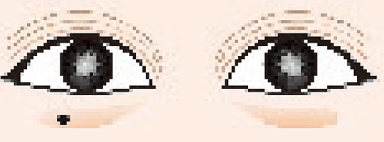 长啥痣的男人不能嫁