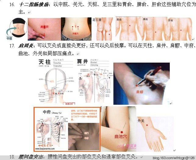 简单易学的艾灸 - 养生堂 - 养生堂