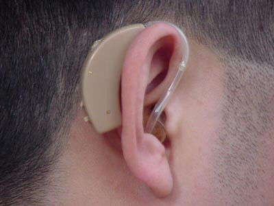 每天拉耳 壮阳奇效 - 缘水禅心 - 