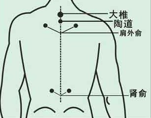 适用型穴位图解 - 铜雀台 - .