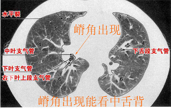 ct肺分页肺窗