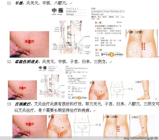 简单易学的艾灸 - 养生堂 - 养生堂