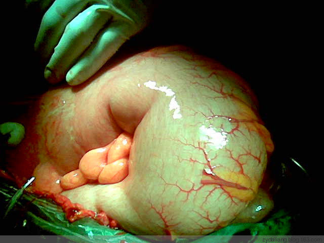 云南白药和蛋清搅匀喝下治疗胃溃疡效果神奇 - 瀛子 - 瀛の小笺