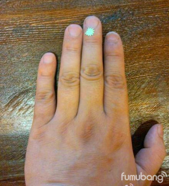 爱护孩子、不打吊针,一目了然的中医妙招 ,感冒发烧、咳嗽、不肯睡觉、留鼻血 - 民间骨膜修复专家 - 青岛叶氏三位一体正骨揉筋针灸术 爱护孩子、不打吊针,一目了然的中医妙招 ,感冒发烧、咳嗽、不肯睡觉、留鼻血。。。。。。 - 民间骨膜修复专家 - 青岛叶氏三位一体正骨揉筋针灸术