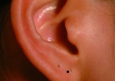 真人全身痣相图解 - 玖玖丸子 - .......