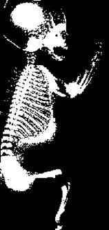 绝世武功论武学（下） - 百花山 - 百花山太极拳