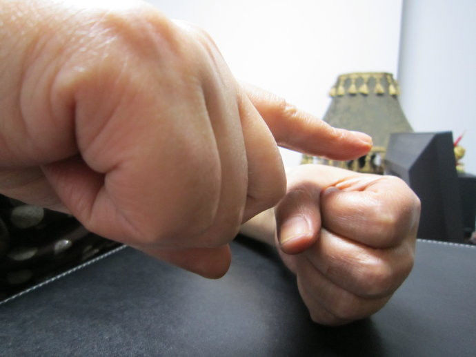 [转] 很神奇的治疗 - 冀公 孙建永 - 冀公 孙建永的博客