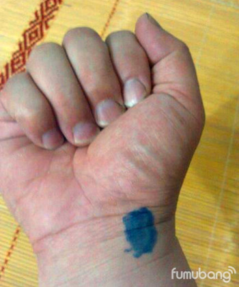 爱护孩子、不打吊针,一目了然的中医妙招 ,感冒发烧、咳嗽、不肯睡觉、留鼻血 - 民间骨膜修复专家 - 青岛叶氏三位一体正骨揉筋针灸术 爱护孩子、不打吊针,一目了然的中医妙招 ,感冒发烧、咳嗽、不肯睡觉、留鼻血。。。。。。 - 民间骨膜修复专家 - 青岛叶氏三位一体正骨揉筋针灸术