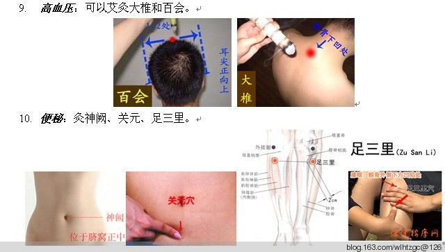 简单易学的艾灸 - 养生堂 - 养生堂