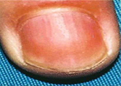 王鹤滨叫好的70秘方 - 天一 - 天人合一