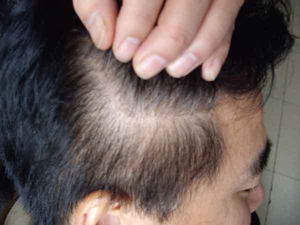 根治白头发小偏方 - 春雨 -    春 雨 伊 甸 园