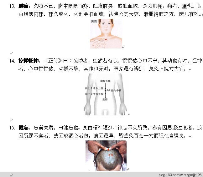简单易学的艾灸 - 养生堂 - 养生堂