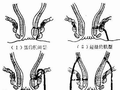 搜狗百科